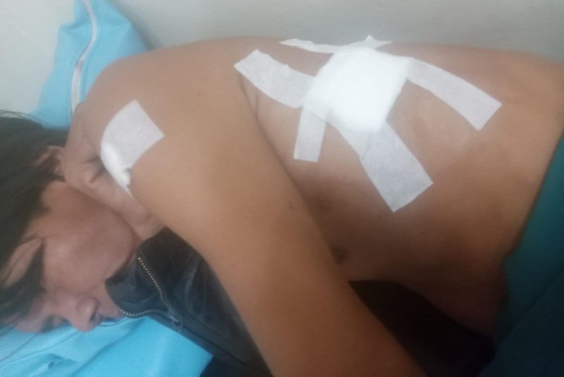 Hendri Syahputra (42), seorang warga Palembang, menjadi korban penusukan. (Foto : Halopos.id)